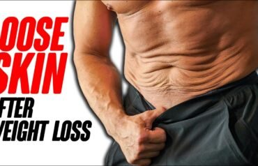 How to Tighten Loose Skin After Weight Loss
