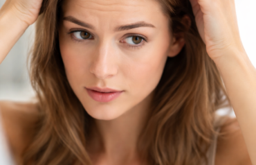 pcos hair loss treatment